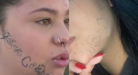 Jovem que teve rosto tatuado pelo ex recebe ajuda para retirar tatuagem, Vale do Paraíba e Região